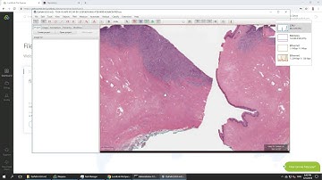 Whole Slide Images for Diagnostic Pathology