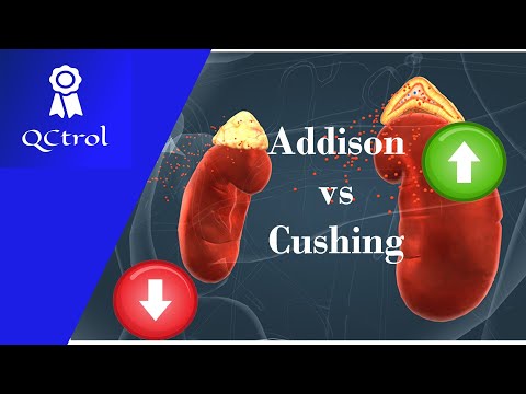 Wideo: Enfermedad de Addison