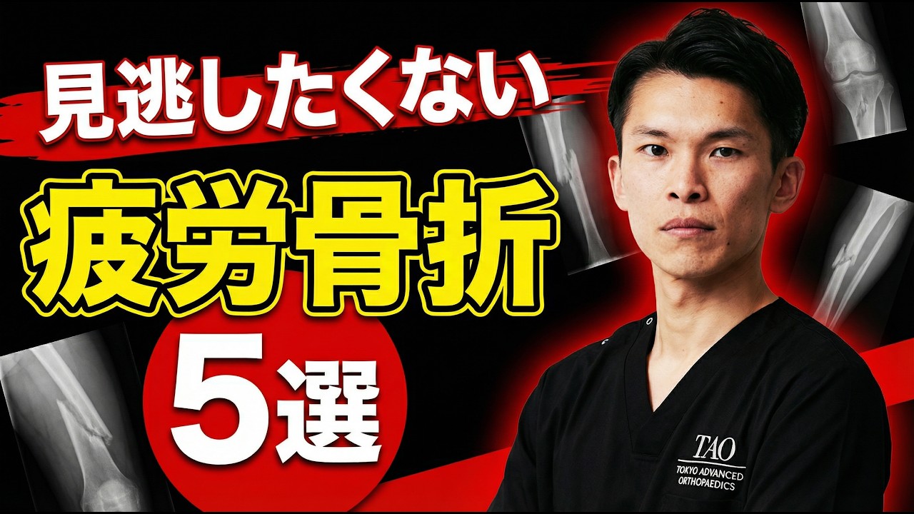 見逃したくない疲労骨折5選