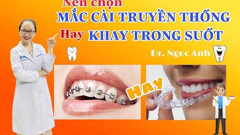 NÊN CHỌN NIỀNG RĂNG MẮC CÀI HAY KHAY TRONG SUỐT? || DR. NGỌC ANH ƠI