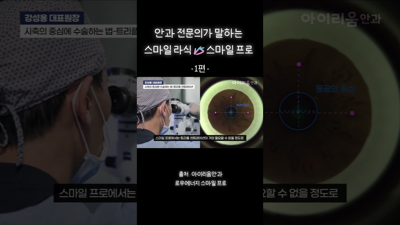 [愛利安眼科診所] 微笑雷射 vs 微笑Pro 比較總整理 第1彈 - #愛利安眼科 #低能量SMILEPro