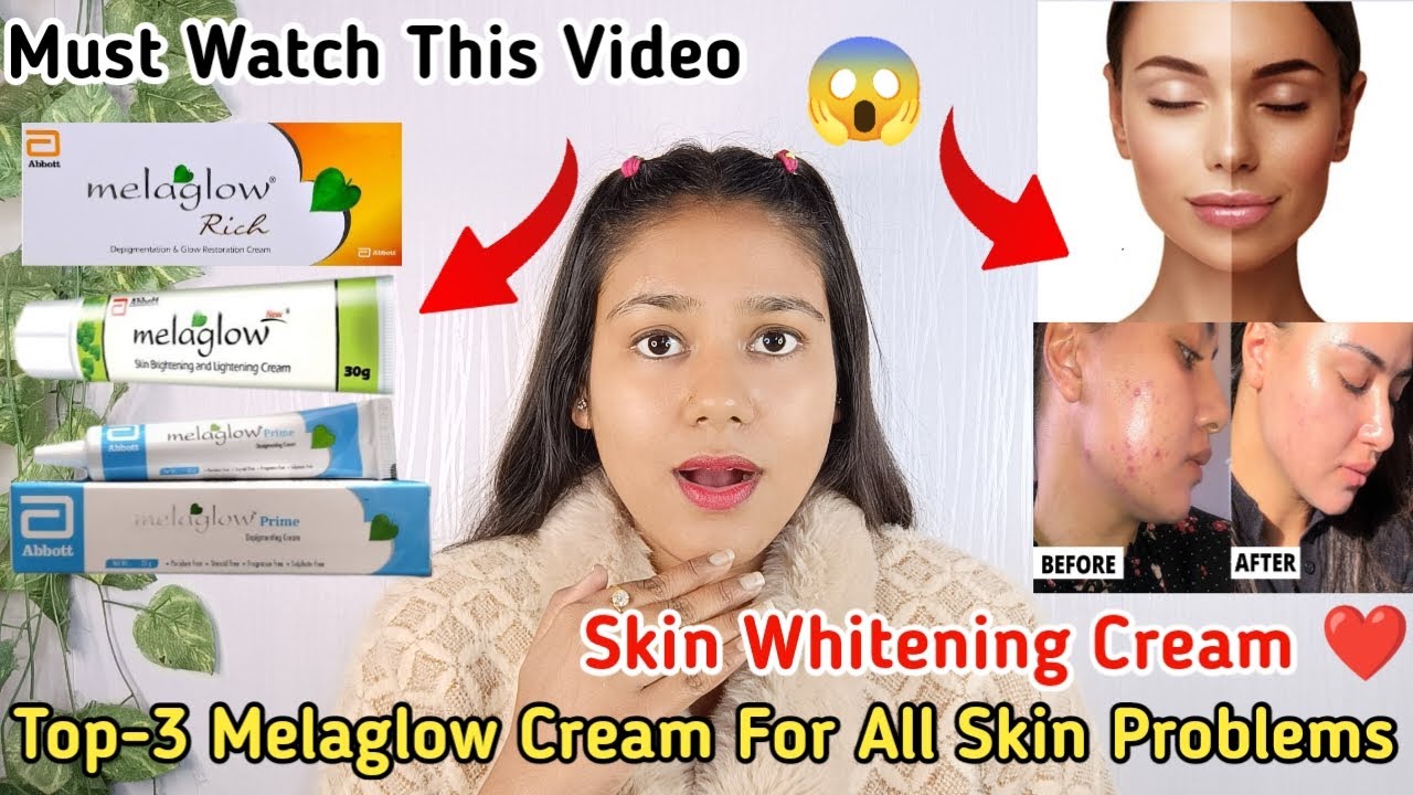 Melaglow Rich Cream ReviewMelaglow Skin Whitening Creamगोरे होने वाली