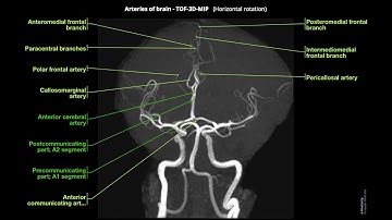 MRA BRAIN , trick to start vessel analysis