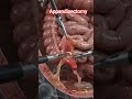 🚨SURGICAL REMOVAL OF PARTS OF BODY.#medical #Appendisectomy #surgical #removal #viral #shorts #fyp