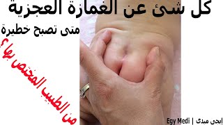 كل شئ عن الغمازه العجزية و متى تصبح خطيرة ؟ و الطبيب المختص بها !