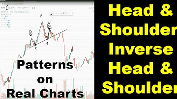 Classic Chart Patterns Part -3 Head & Shoulders, Inverted Head & Shoulders, W & M on Real Charts