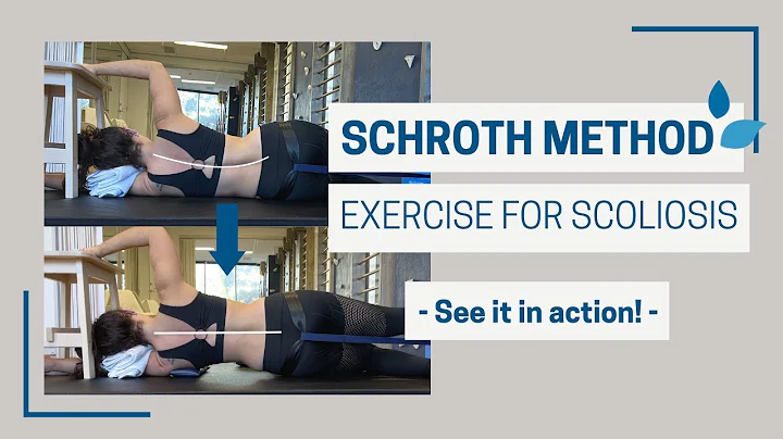 SCHROTH METHOD demo - Side-Lying Scoliosis Treatme...