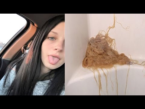 Teen Melts Off Her Hair With Bleach