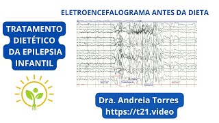 EFICÁCIA DA DIETA CETOGÊNICA NA SÍNDROME DE DOOSE | APRENDA NUTRIÇÃO