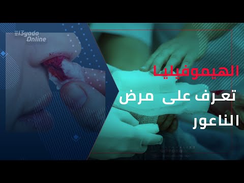 مرض الناعور أعراضه وأسبابه
