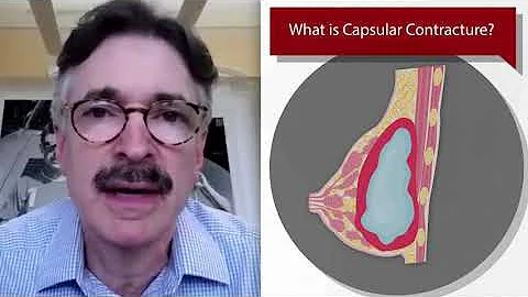Ways to Treat Capsular Contracture. Plastic Surger...