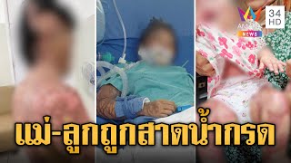 กัน จอมพลัง บุกช่วยแม่-ลูก ถูกเมียเก่าผัวสาดน้ำกรดใส่เละทั้งตั้ว| ข่าวอรุณอมรินทร์ | 29/4/67