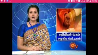 Nagakanni speaking about metti