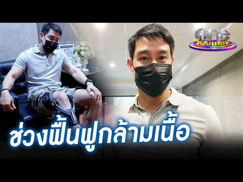 "ป้อง" ยังต้องกายภาพ หลังผ่าตัดเอ็นไขว้หน้าเข่าขาด | ประเด็นร้อน