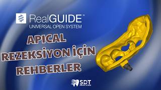 RealGUIDE ile Apical Rezeksiyon İçin Rehber Tasarımı // Guide Planning For Apical Resection