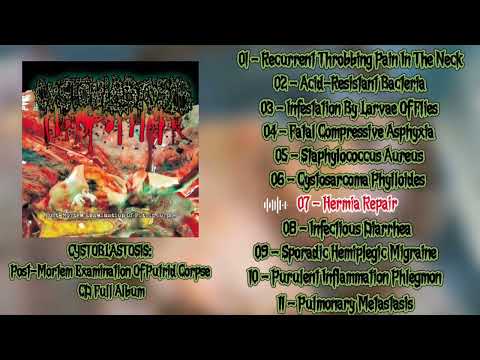 Post-Mortem Examination Of Putrid Corpse artwork