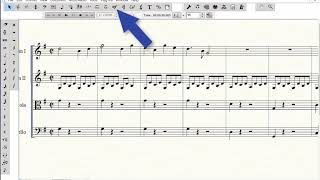 HyperScribe (Real TIme) Entry - Cleaning Up Your Recording