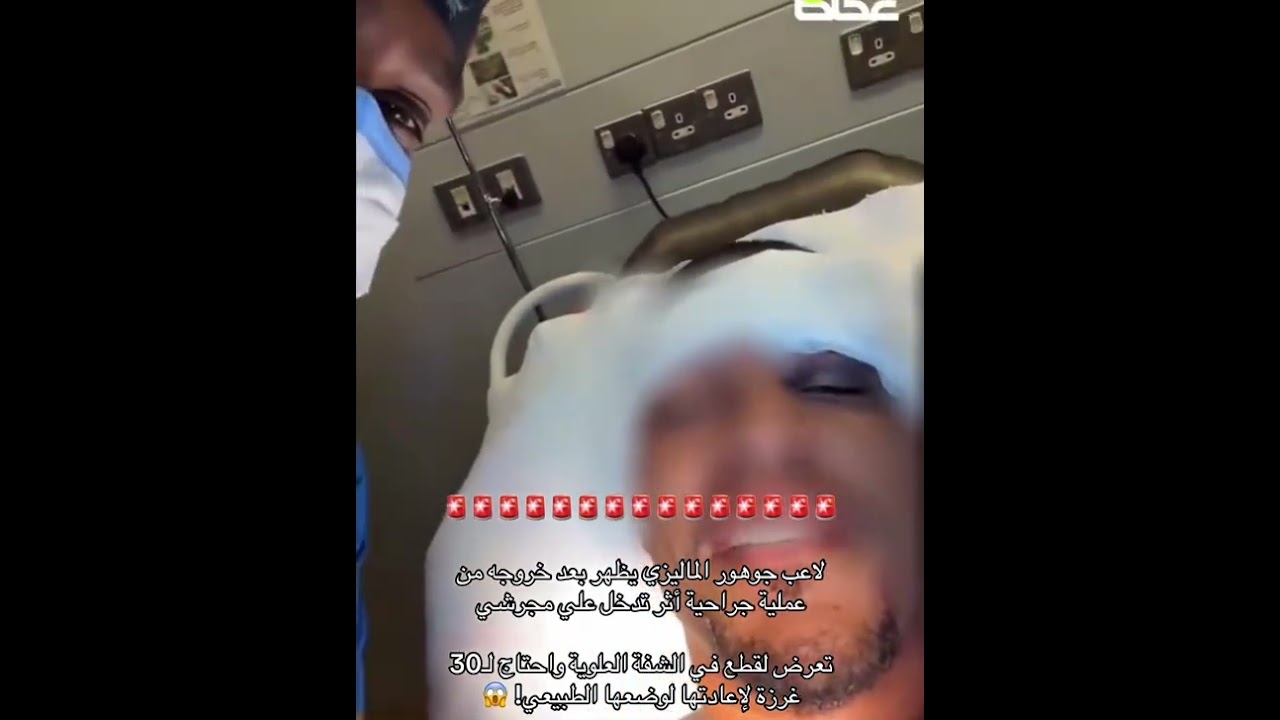 لاعب جوهور تعرض لقطع في الشفة العلويه واحتاج لـ 30 غرزة لاعادتها لوضعها الطبيعي😱!