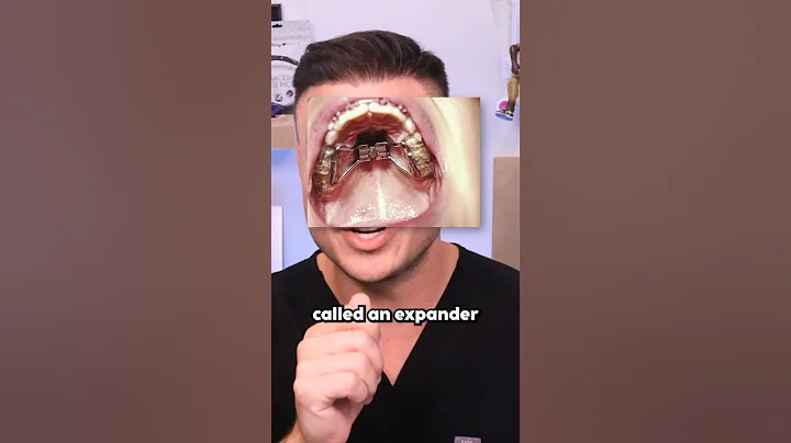 This Will Stretch Out Your Mouth PERMANENTLY?!