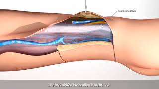 Radial forearm flap harvest