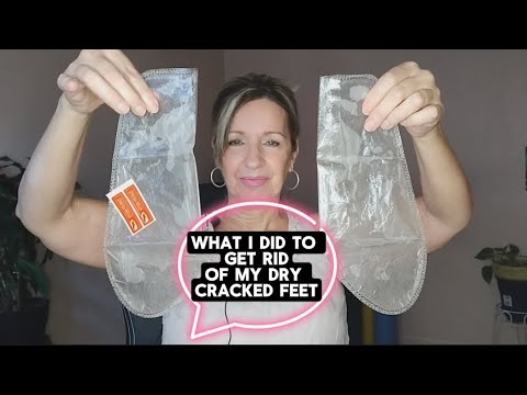 The Foot Peel That( Solved My Dry Cracked Feet)! - YouTube