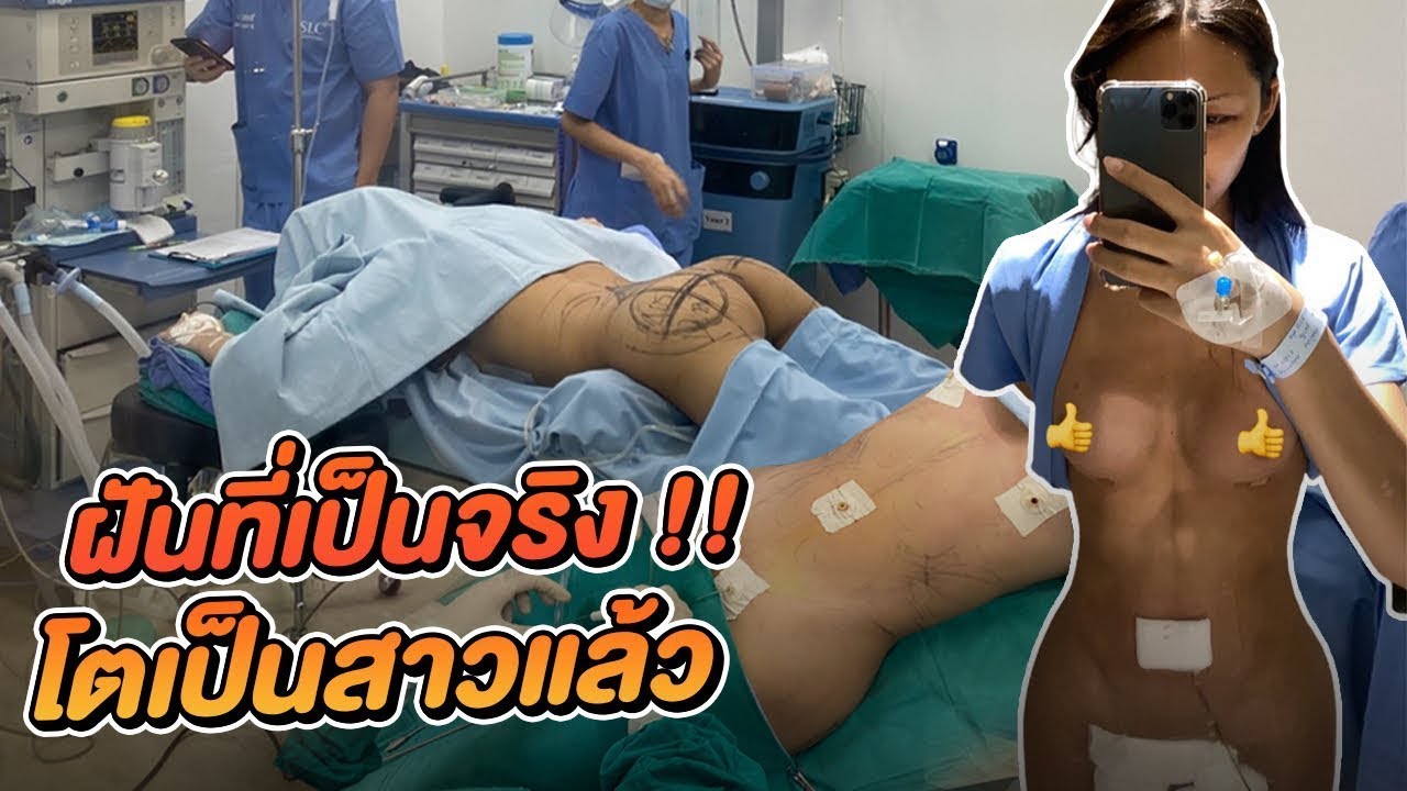 เฉลยผ่าตัดใหญ่ช่วงล่าง ! การเปลี่ยนแปลงครั้งใหญ่ในชีวิต ตัดสินใจดีแล้ว … Eng sub | ข้อมูลทั้งหมดเกี่ยวกับหำ สวยที่แม่นยำที่สุด