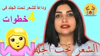 أقوى طريقة فعالة ومضمونة للتخلص من الشعر تحت الجلد في أربع خطوات – get rid of ingrown hair