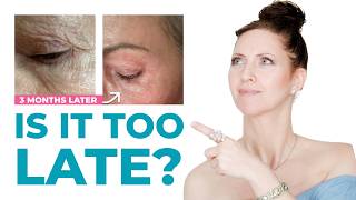 Famous Erase Decades of Damage: Skincare Secrets for Women Over 65 Net Worth