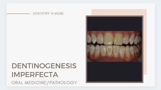 DENTINOGENESIS IMPERFECTA
