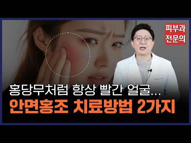 항상 빨간 얼굴로 고민하는 안면홍조 치료방법ㅣ주사증 치료ㅣ피부과전문의