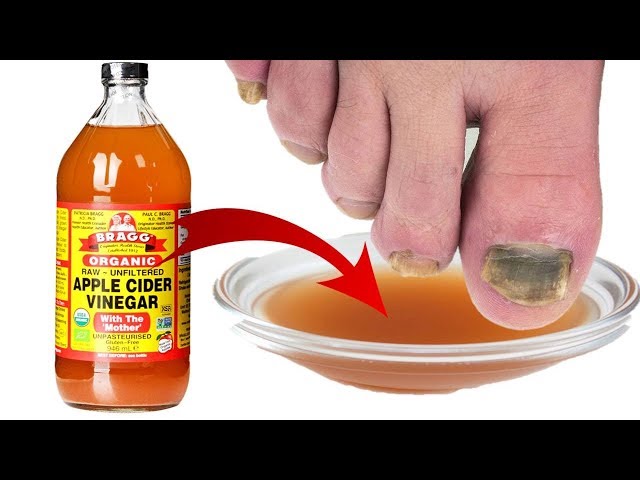 Apple Cider Vinegar Soak for Healthy Nails - YouTube