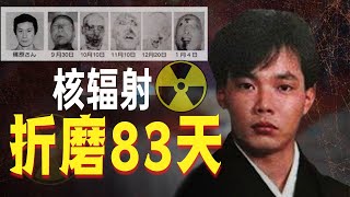 日本恐怖核事故，他遭受2万倍的辐射量，却成了医生的研究材料，世界上死的最惨的人【弗洛1得】