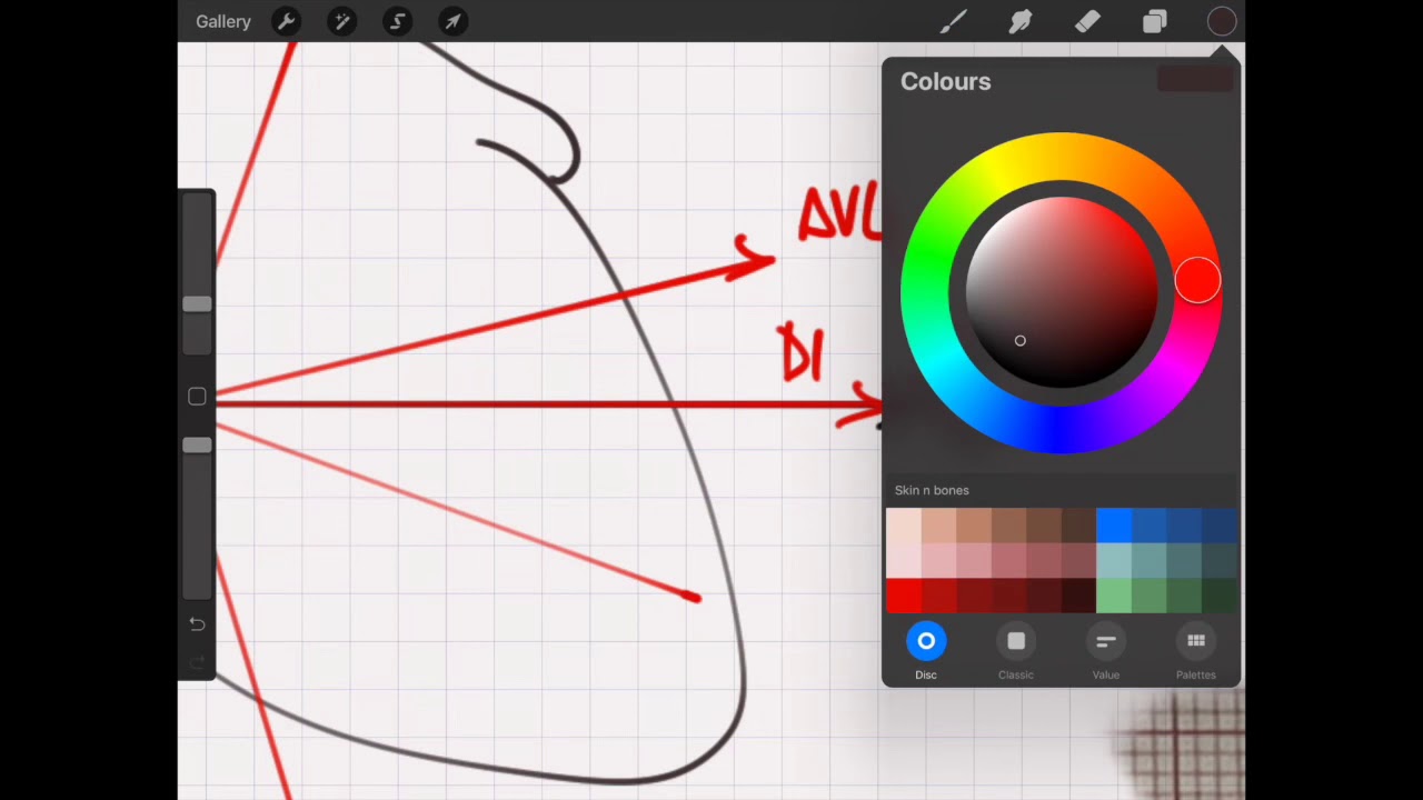 El eje cardiaco PASO A PASO