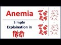 Anemia & its types simple explaination in Hindi | Bhushan Science