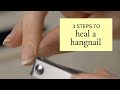 3 steps to heal a hangnail