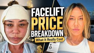 How Much My Deep Plane Facelift REALLY Cost | Full Price Breakdown