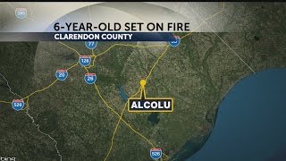 6-year-old set on fire by 12-year-old in Clarendon County, organization says