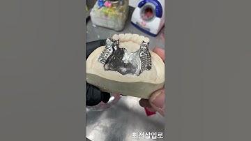 #dentures #파샬프레임 #회전삽입로 #칠성시장 #JDdentallab