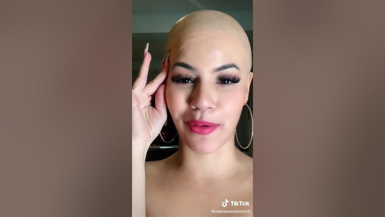 Asi Es Como Mariana Se Quito La Pelona Que Tenia😬🤕 YouTube