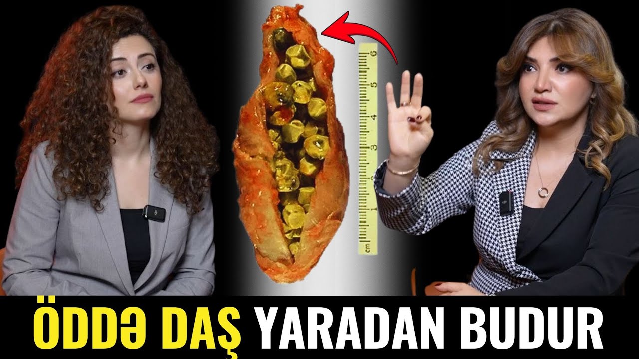 ÖD KİSƏSİ Xəstəliklərini Yaradan Budur! VACİB