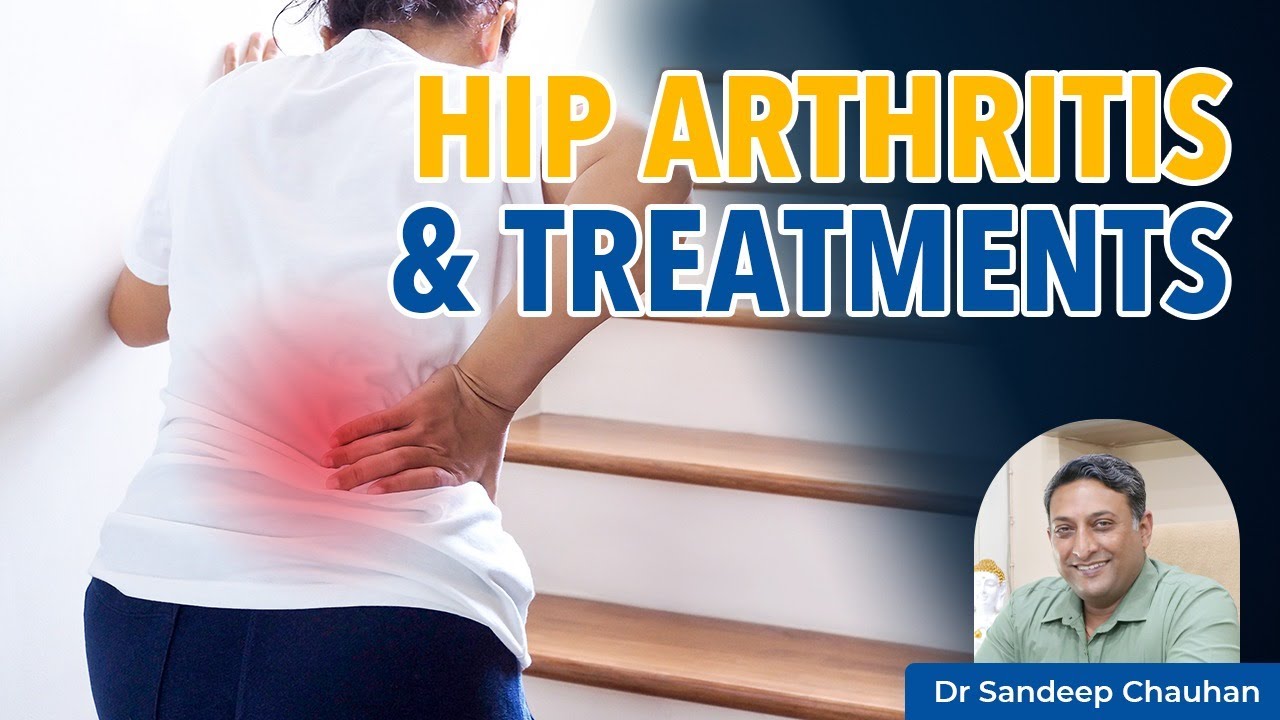 Hip Pain क्यों होता है Hip Arthritis Symptoms And Treatment in Hindi