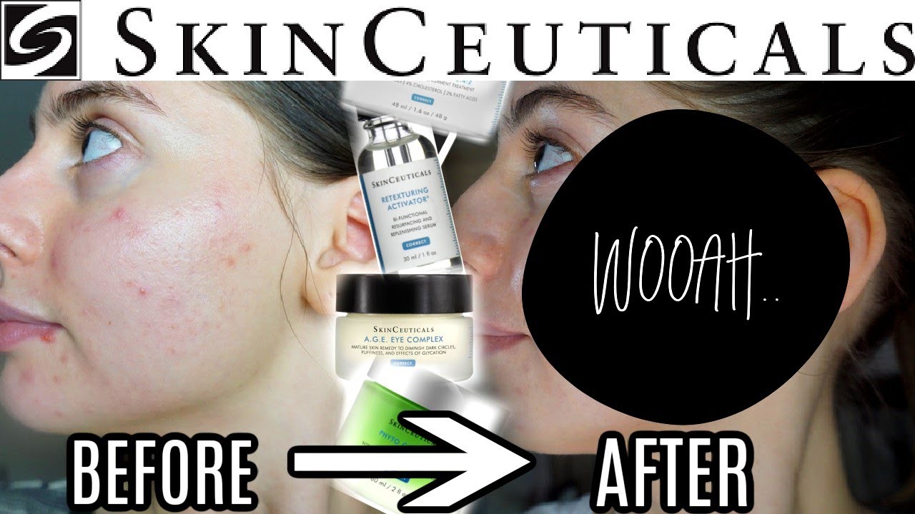 video SKINCEUTICALS Discoloration Defense Serum