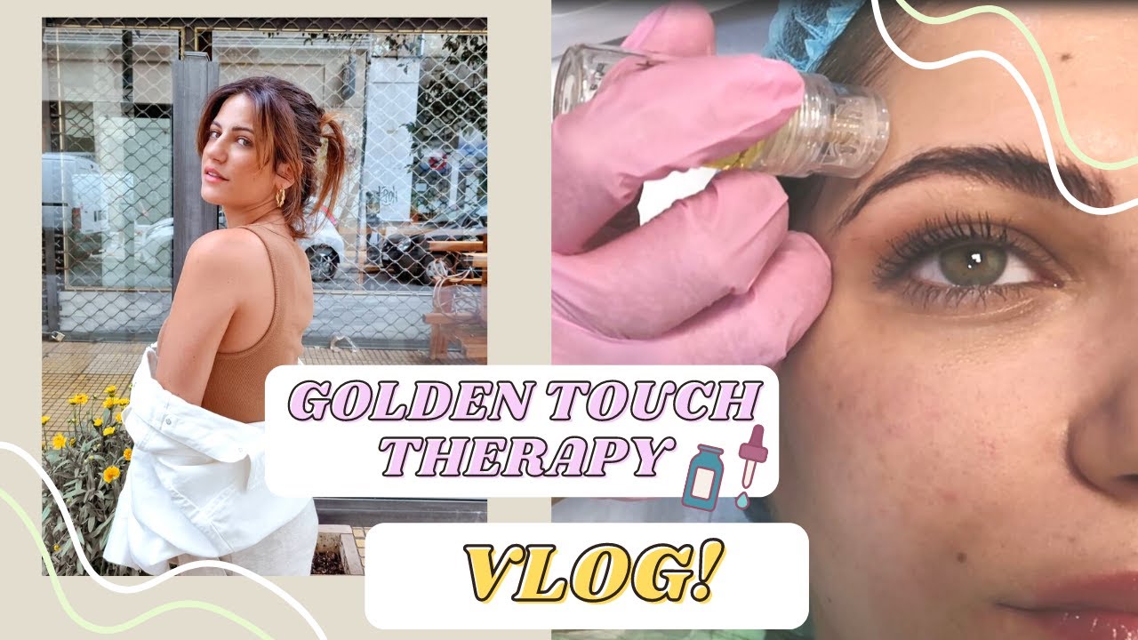 VLOG: Μεσοθεραπεία που λειτουργεί σαν filler?😱