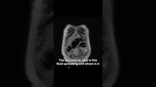 16/100 | Random Radiology Dump | #mri #foamrad #radiologyshorts