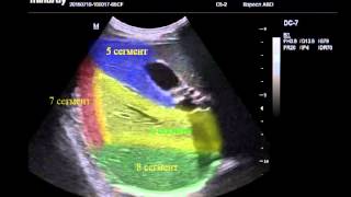 Эхографическая анатомия и техника проведения исследования печени