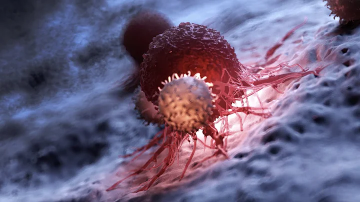 How CAR T could save more cancer patients' lives |...