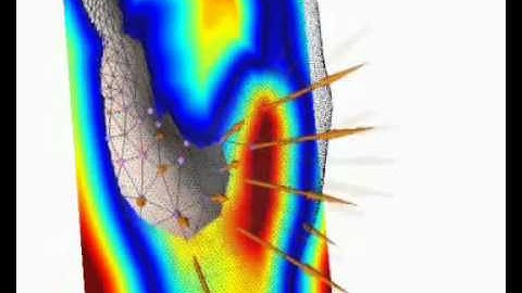 Competing fronts for coarse-to-fine surface reconstruction