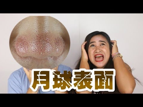 MKUP美咖 【超療癒😭巨大粉刺林大噴發 幫你把它通通大掃除】