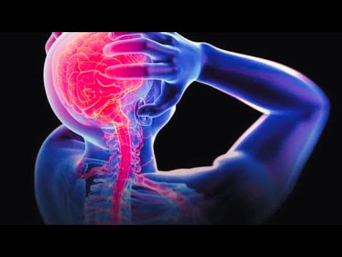 Astaamaha Xanuunada Neerfaha Neerfaha Madaxa Neerfaha Lugaha