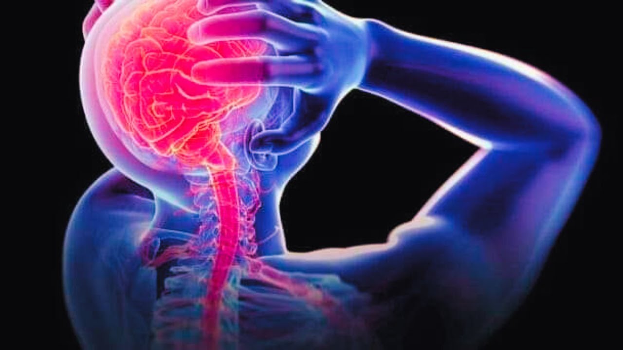 Astaamaha Xanuunada Neerfaha | neerfaha madaxa | neerfaha lugaha